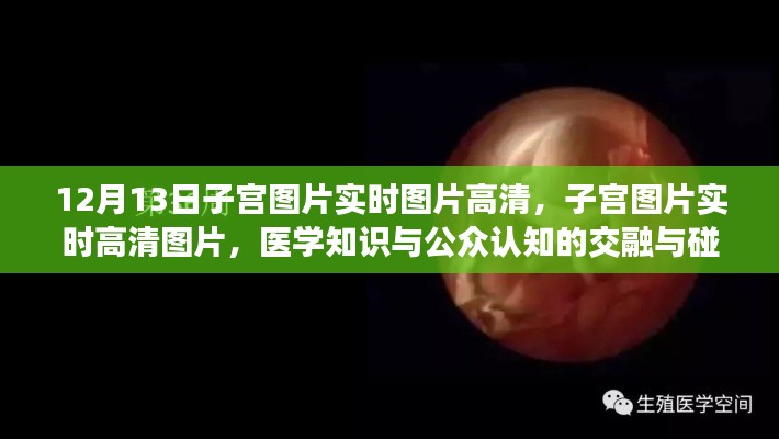 醫(yī)學(xué)知識與公眾認(rèn)知交融，高清子宮圖片實時展示與探討