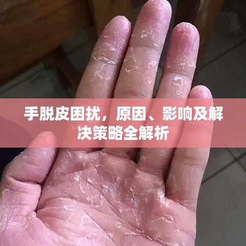 手脫皮困擾，原因、影響及解決策略全解析
