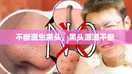 不斷滋生黑頭，黑頭源源不斷 
