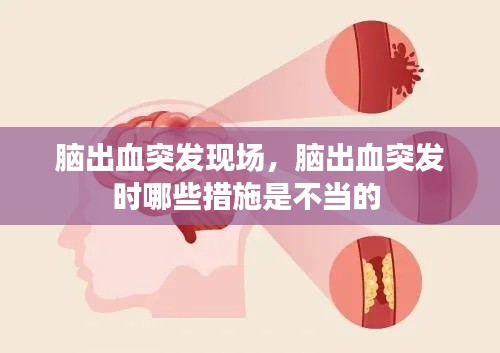 腦出血突發(fā)現(xiàn)場，腦出血突發(fā)時哪些措施是不當?shù)?