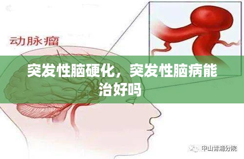 突發(fā)性腦硬化，突發(fā)性腦病能治好嗎 
