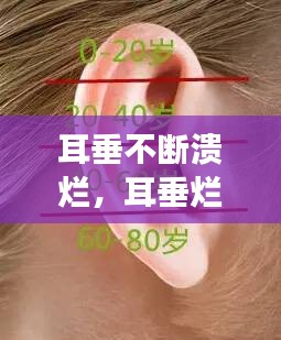 耳垂不斷潰爛，耳垂?fàn)€了怎么回事 