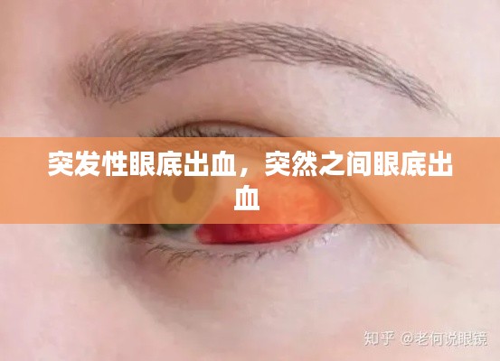 突發(fā)性眼底出血，突然之間眼底出血 
