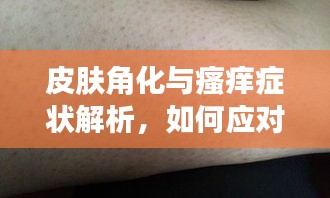 皮膚角化與瘙癢癥狀解析，如何應對角化帶來的困擾？