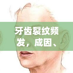 牙齒裂紋頻發(fā)，成因、影響及應(yīng)對(duì)良方