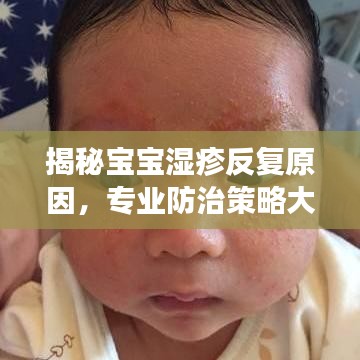 揭秘寶寶濕疹反復原因，專業(yè)防治策略大解析！